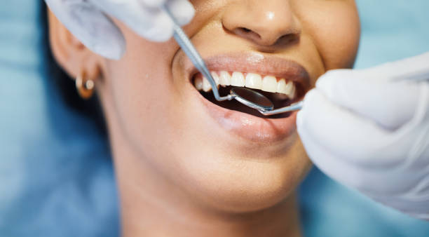 Best Broken or Chipped Tooth Repair in Karnes City, TX
